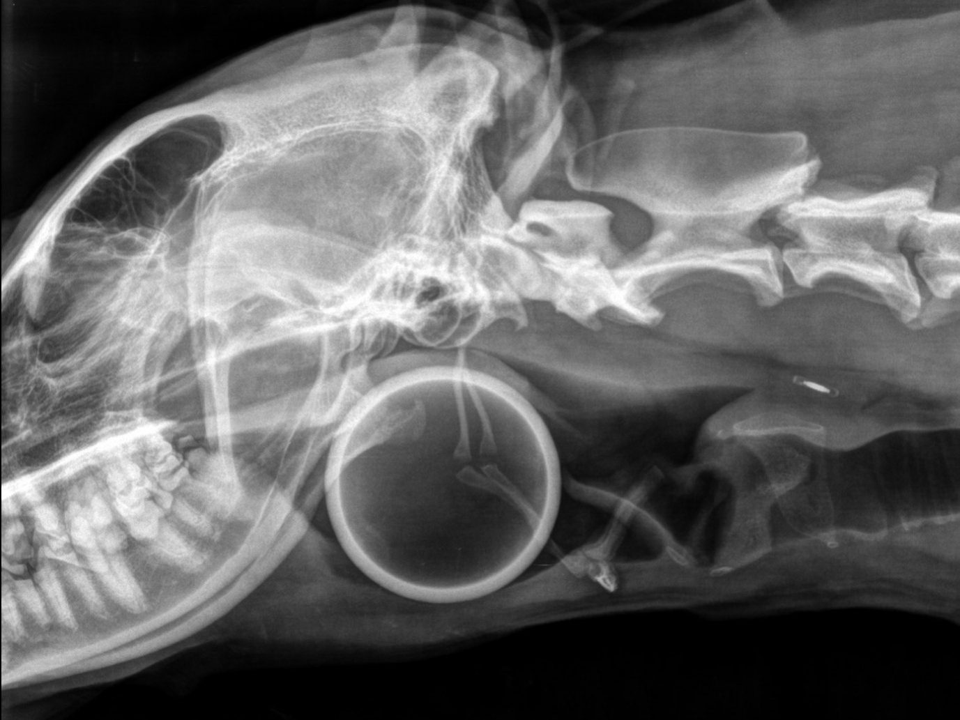 Corps-etranger-pharynge