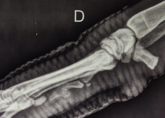 Cas clinique - double arthrodèse des carpes - V24 Clinique vétérinaire